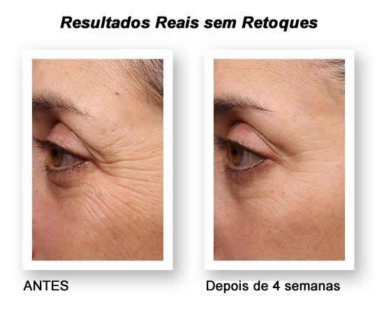 linhas de expressao creme rejuvenescedor resultados